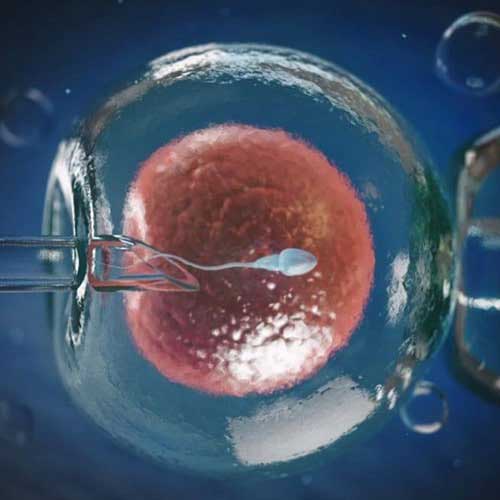 Intracytoplasmic Sperm Injection (ICSI) in Delhi