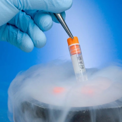 Egg Freezing (Oocyte Cryopreservation) in Delhi